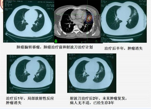 ��֢���䲨������