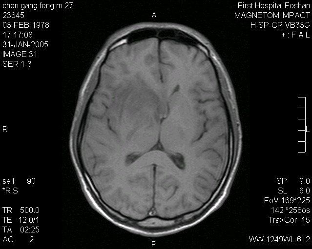 �䲨������