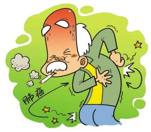 �ΰ������󷢲�ԭ��