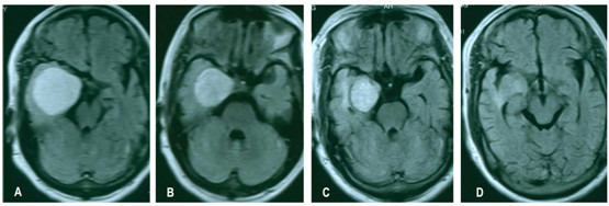 �䲨��������Ĥ������