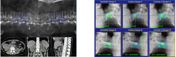 ����׷��