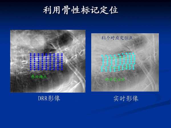 ���ù��Ա�Ƕ�λ